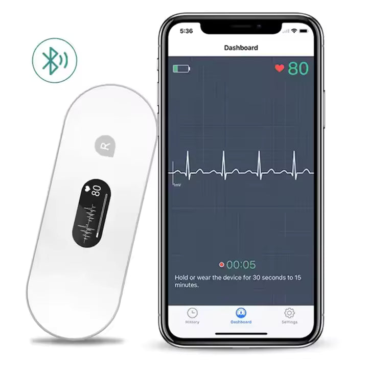 Mobile ECG Recorder